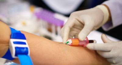 Odvzem krvi na domu pri medicinski sestri